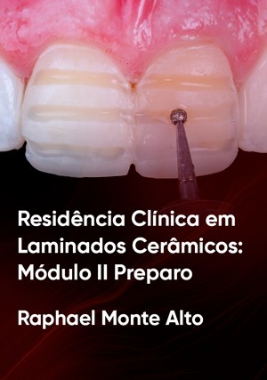 Cover for Residência Clínica em Laminados Cerâmicos: Módulo II Preparo