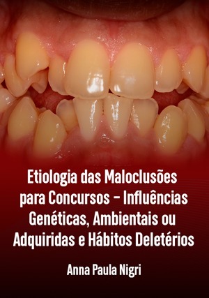 Cover for Etiologia das Maloclusões para Concursos - Influências Genéticas, Ambientais ou Adquiridas e Hábitos Deletérios