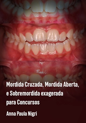 Cover for Mordida Cruzada, Mordida Aberta, e Sobremordida Exagerada para Concursos