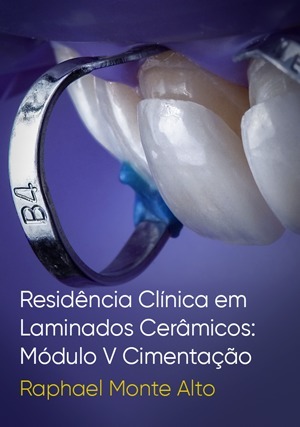 Cover for Residência Clínica em Laminados Cerâmicos: Módulo V Cimentação