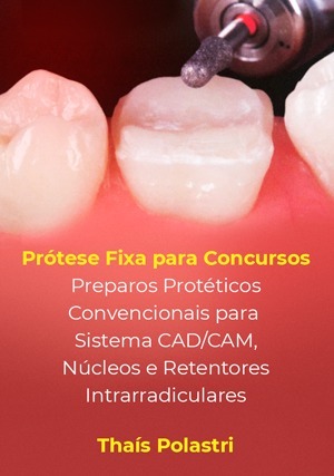 Cover for Prótese Fixa Para Concursos: Preparos Protéticos Convencionais e para Sistema CAD/CAM, Núcleos e Retentores Intrarradiculares