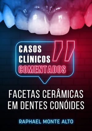 Cover for Casos Clínicos Comentados: Facetas Cerâmicas em Dentes Conóides