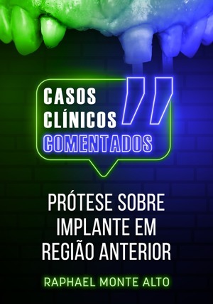 Cover for Casos Clínicos Comentados: Prótese sobre Implante em Região Anterior