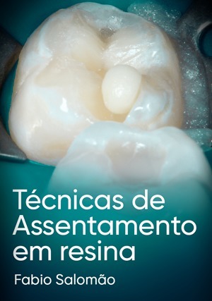 Cover for Técnicas de Assentamento em Resina