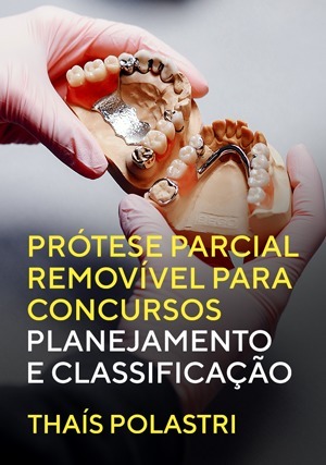 Cover for Prótese Parcial Removível para Concursos: Planejamento e Classificação