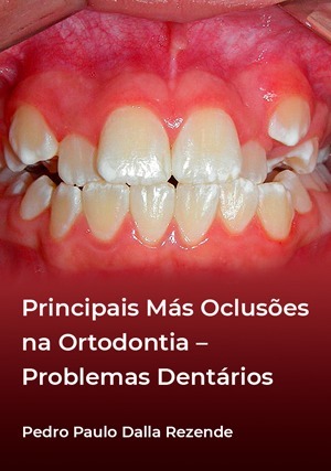 Cover for Principais Más Oclusões na Ortodontia: Problemas Dentários