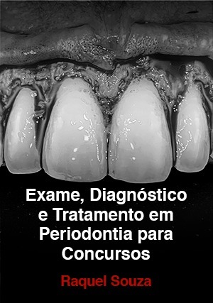 Cover for Exame, Diagnóstico e Tratamento em Periodontia para Concursos