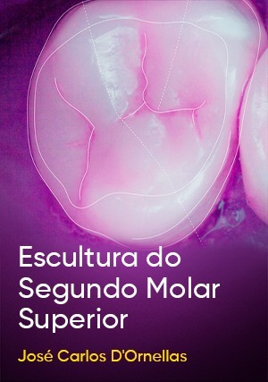 Cover for Escultura do Segundo Molar Superior