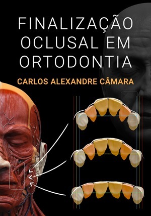 Cover for Finalização Oclusal em Ortodontia