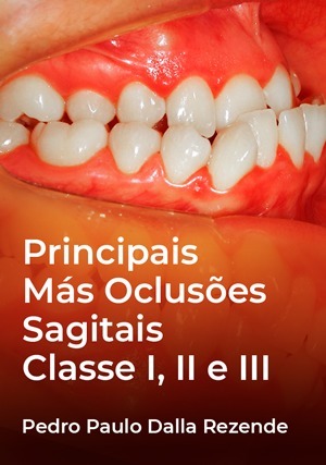 Cover for Principais Más oclusões Sagitais: Classe I, II e III