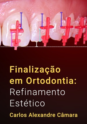 Cover for Finalização em Ortodontia: Refinamento Estético