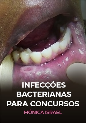 Cover for Infecções Bacterianas para Concursos