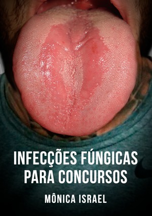 Cover for Infecções Fúngicas para Concursos