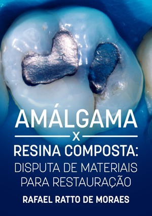 Cover for Amálgama x Resina Composta: Disputa de Materiais para Restauração
