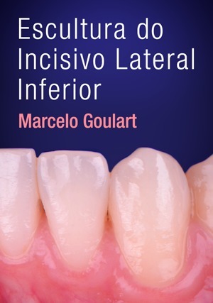 Cover for Escultura do Incisivo Lateral Inferior