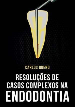 Cover for Resolução de Casos Complexos na Endodontia