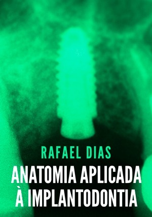 Cover for Anatomia Aplicada à Implantodontia