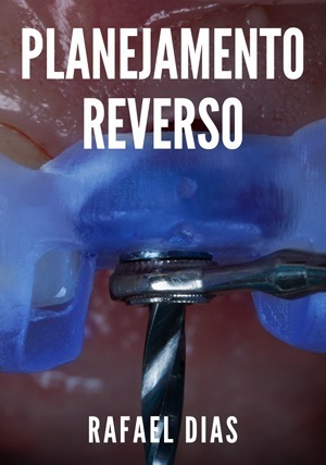Cover for Planejamento Reverso