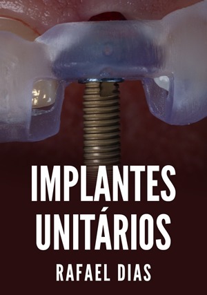 Cover for Implantes Unitários