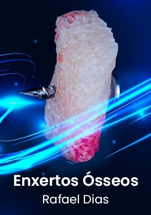 Cover for Enxertos Ósseos