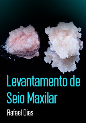 Cover for Levantamento de Seio Maxilar