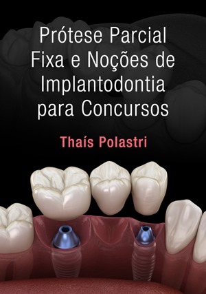 Cover for Prótese Parcial Fixa e Noções de Implantodontia para Concursos