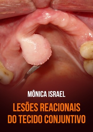 Cover for Lesões Reacionais do Tecido Conjuntivo