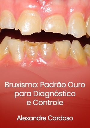 Cover for Bruxismo: Padrão Ouro para Diagnóstico e Controle
