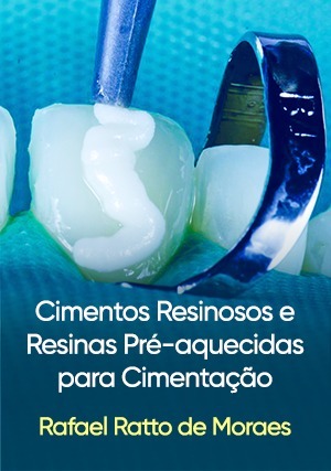 Cover for Cimentos Resinosos e Resinas Pré-aquecidas para Cimentação