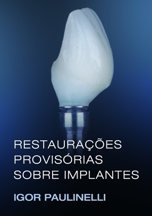 Cover for Restaurações Provisórias sobre Implantes