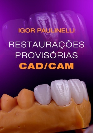 Cover for Restaurações Provisórias CAD/CAM