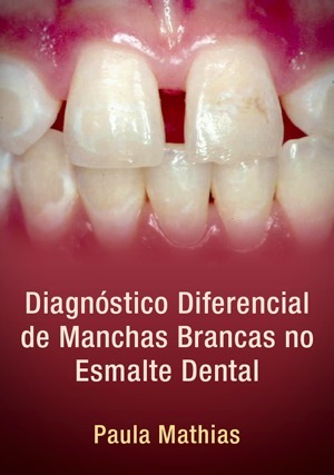 Cover for Diagnóstico Diferencial de Manchas Brancas no Esmalte Dental