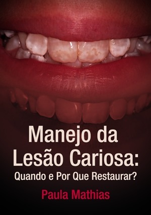 Cover for Manejo da Lesão Cariosa: Quando e Por que Restaurar?