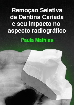 Cover for Remoção Seletiva de Dentina Cariada e seu Impacto no Aspecto Radiográfico
