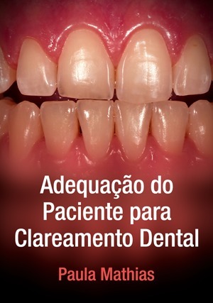 Cover for Adequação do Paciente para Clareamento Dental