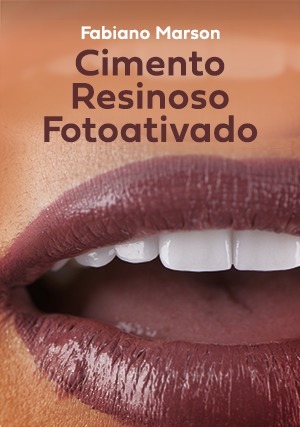 Cover for Cimento Resinoso Fotoativado