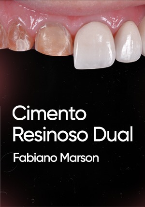 Cover for Cimento Resinoso Dual