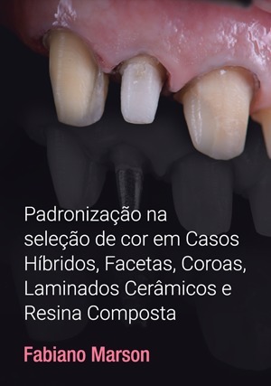 Cover for Padronização na Seleção de Cor em Casos Híbridos, Facetas, Coroas e Laminados Cerâmicos