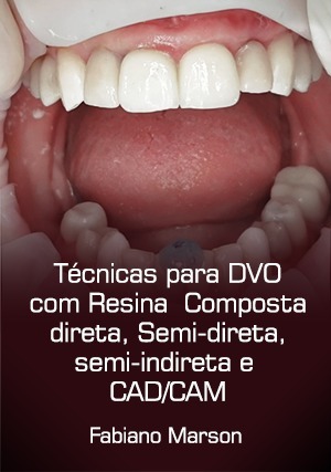 Cover for Técnicas para DVO com Resina Composta Direta, Semi-Direta, Semi-Indireta e CAD/CAM