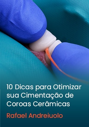 Cover for 10 Dicas para Otimizar sua Cimentação de Coroas Cerâmicas
