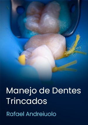 Cover for Manejo de Dentes Trincados