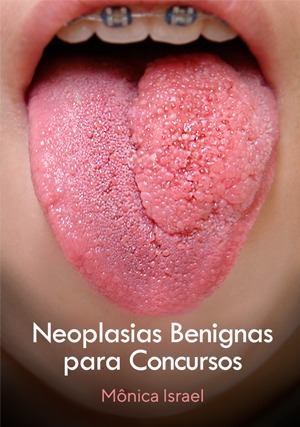 Cover for Neoplasias Benignas para Concursos