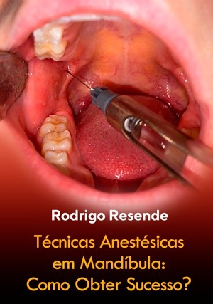 Cover for Técnicas Anestésicas em Mandíbula: Como Obter Sucesso?