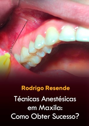 Cover for Técnicas Anestésicas em Maxila: Como Obter Sucesso?