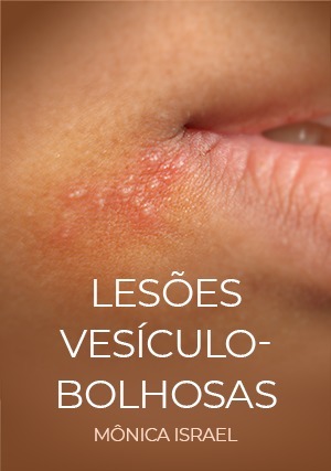 Cover for Lesões Vesículo-bolhosas