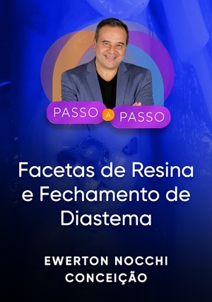 Cover for Passo a Passo Clínico: Facetas de Resina e Fechamento de Diastema