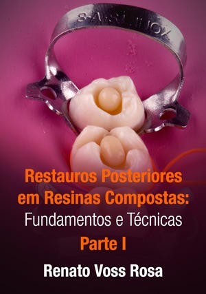 Cover for Restauros Posteriores em Resinas Compostas: Fundamentos e Técnicas