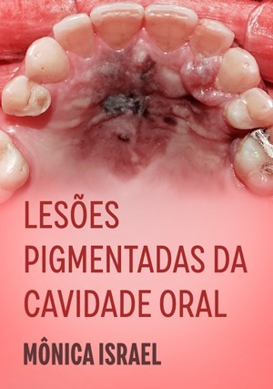 Cover for Lesões Pigmentadas da Cavidade Oral