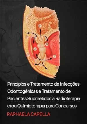 Cover for Princípios e Tratamento de Infecções Odontogênicas e Tratamento de Pacientes Submetidos à Radioterapia e/ou Quimioterapia para C