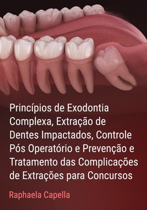 Cover for Princípios de Exodontia Complexa, Extração de dentes impactados, Pós Operatório e Complicações de Extrações para concursos
